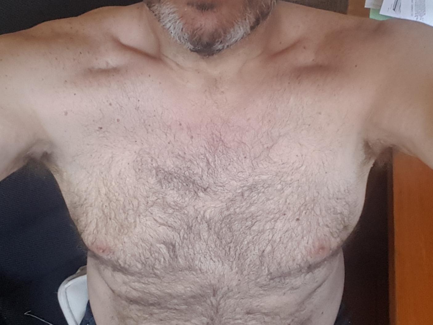 HomoAlpha