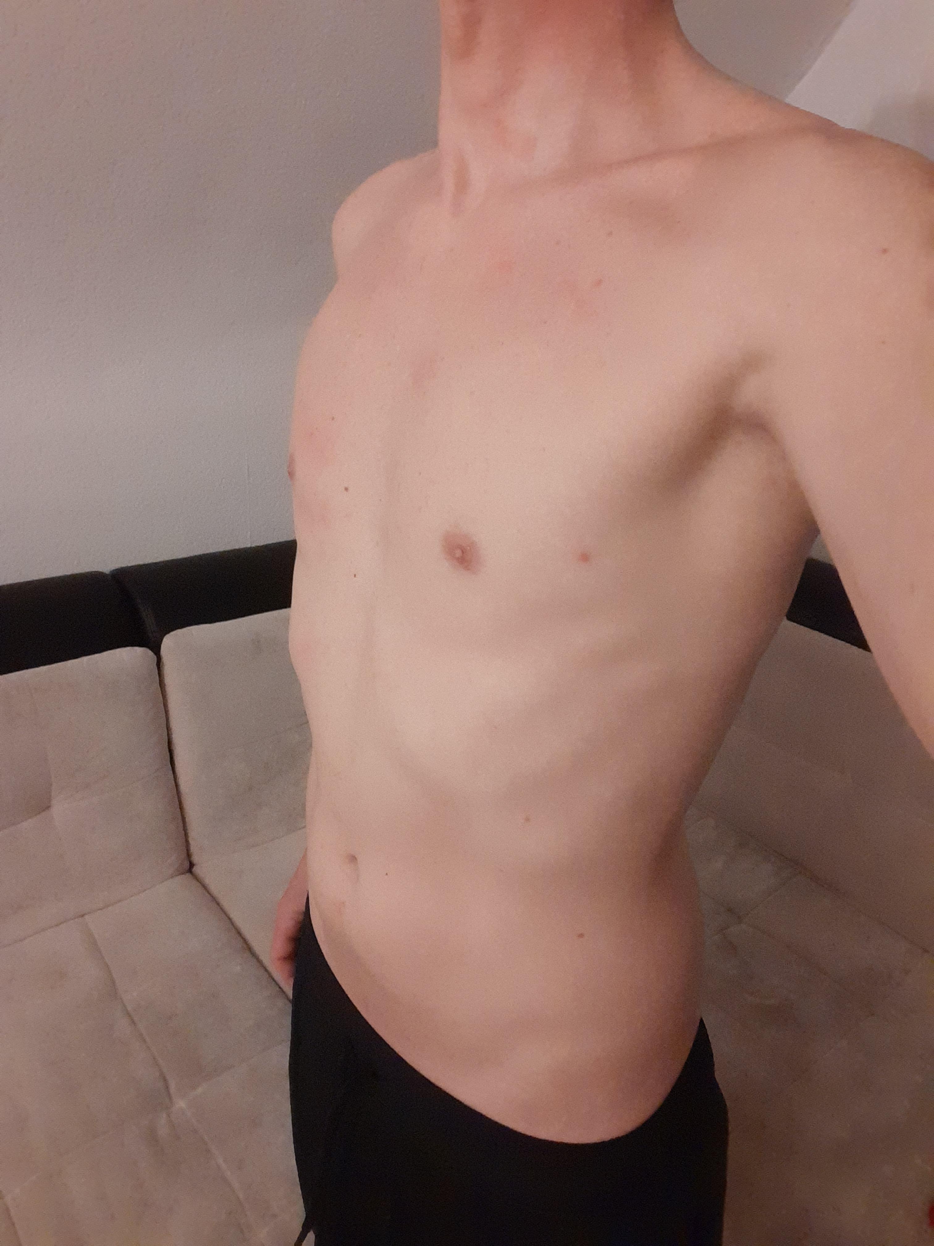 Nymphofux Live Image